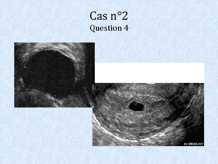 Cas n° 2 Question 4 