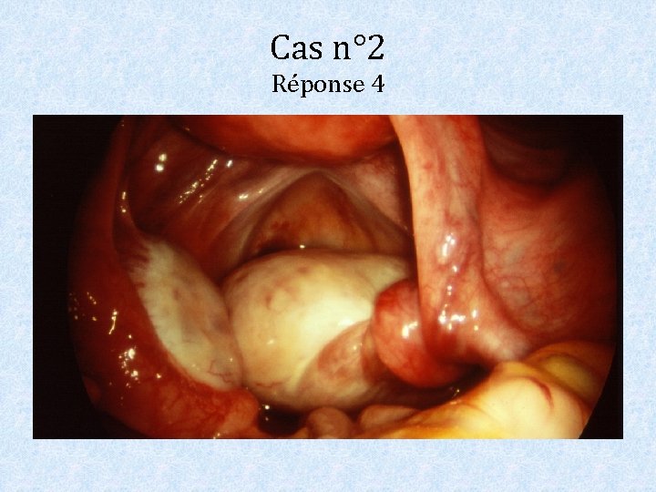 Cas n° 2 Réponse 4 