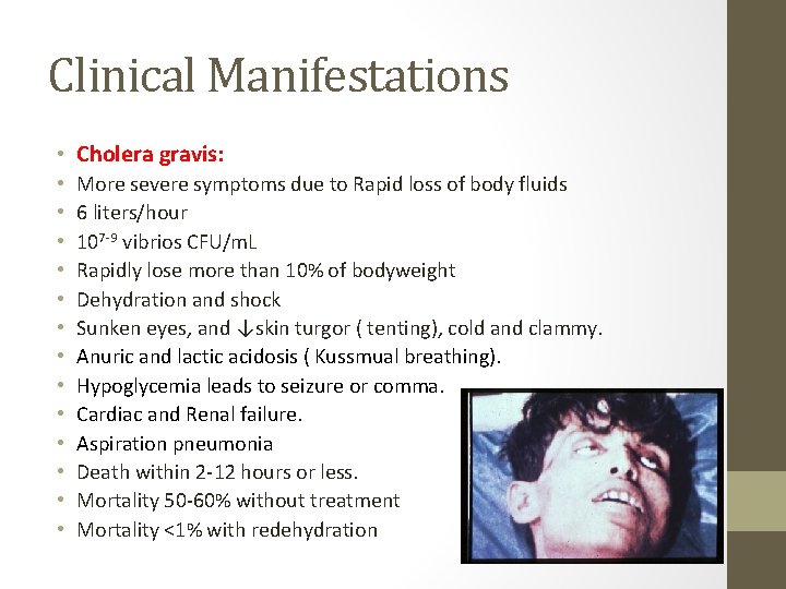 Clinical Manifestations • Cholera gravis: • • • • More severe symptoms due to