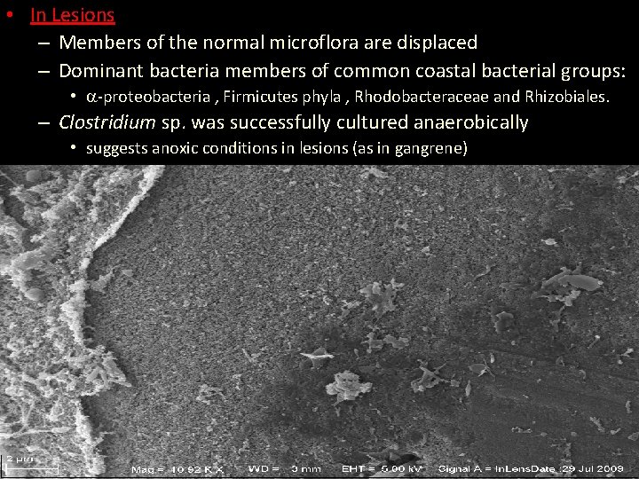  • In Lesions – Members of the normal microflora are displaced – Dominant