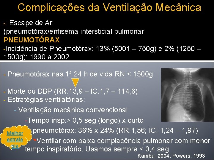 Complicações da Ventilação Mecânica Escape de Ar: (pneumotórax/enfisema intersticial pulmonar PNEUMOTÓRAX -Incidência de Pneumotórax: