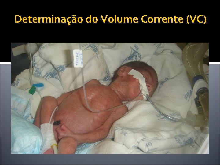 Determinação do Volume Corrente (VC) 