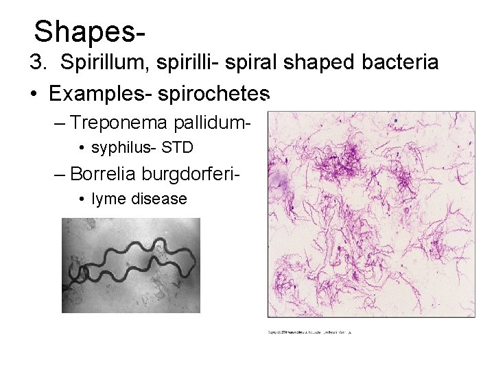 Shapes 3. Spirillum, spirilli- spiral shaped bacteria • Examples- spirochetes – Treponema pallidum • Shapes 3. Spirillum, spirilli- spiral shaped bacteria • Examples- spirochetes – Treponema pallidum •
