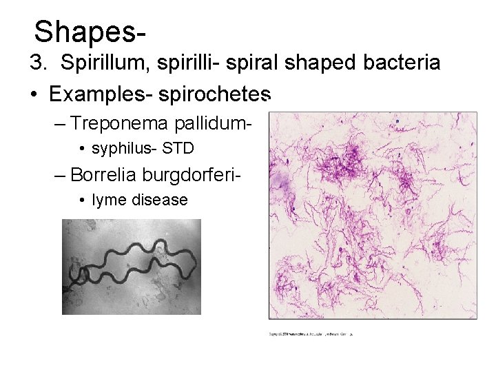 Shapes 3. Spirillum, spirilli- spiral shaped bacteria • Examples- spirochetes – Treponema pallidum •