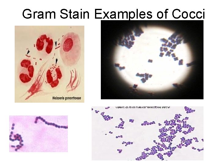Gram Stain Examples of Cocci Gram Stain Examples of Cocci