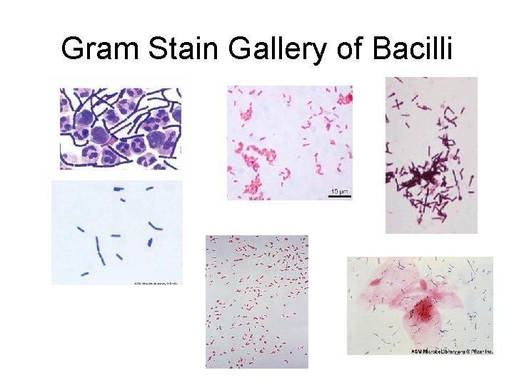 Gram Stain Gallery of Bacilli 