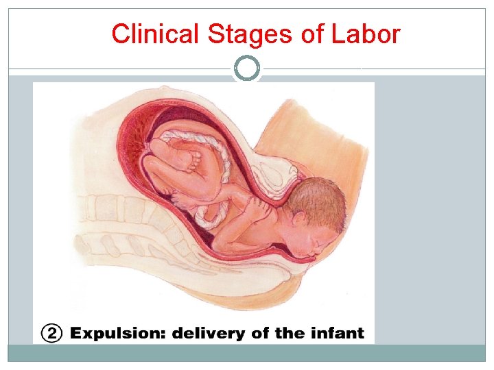 Clinical Stages of Labor Clinical Stages of Labor