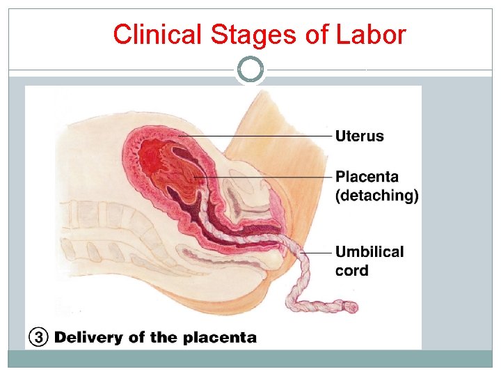 Clinical Stages of Labor Clinical Stages of Labor