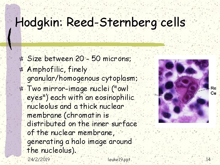 Hodgkin: Reed-Sternberg cells Size between 20 - 50 microns; Amphofilic, finely granular/homogenous cytoplasm; Two