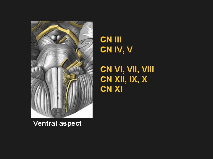 CN III CN IV, V CN VI, VIII CN XII, IX, X CN XI