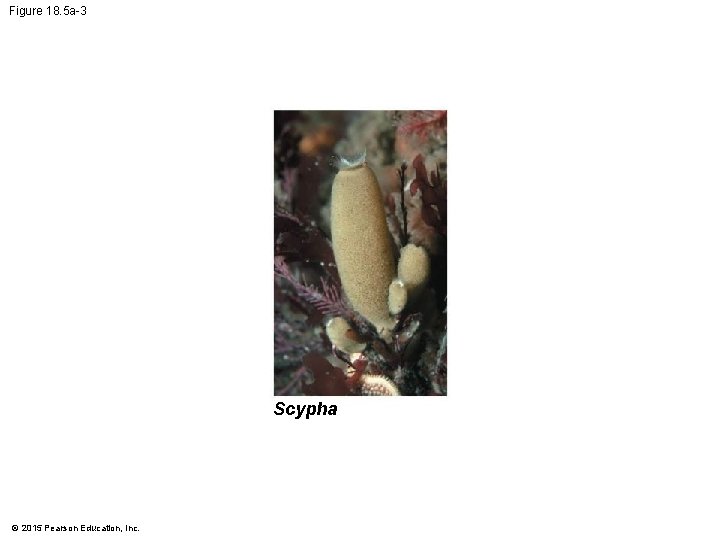 Figure 18. 5 a-3 Scypha © 2015 Pearson Education, Inc. 