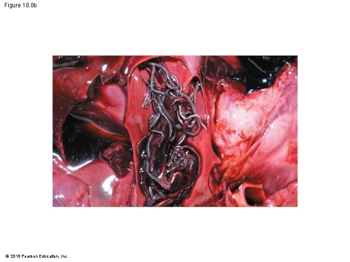 Figure 18. 8 b © 2015 Pearson Education, Inc. 