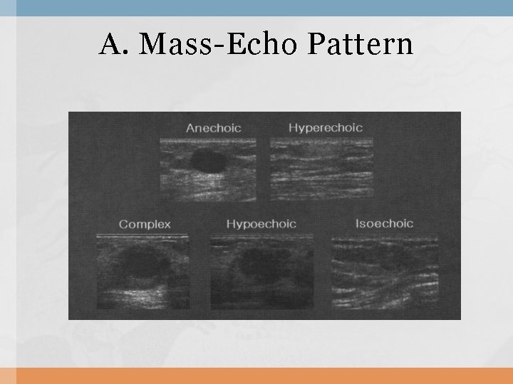 A. Mass-Echo Pattern 