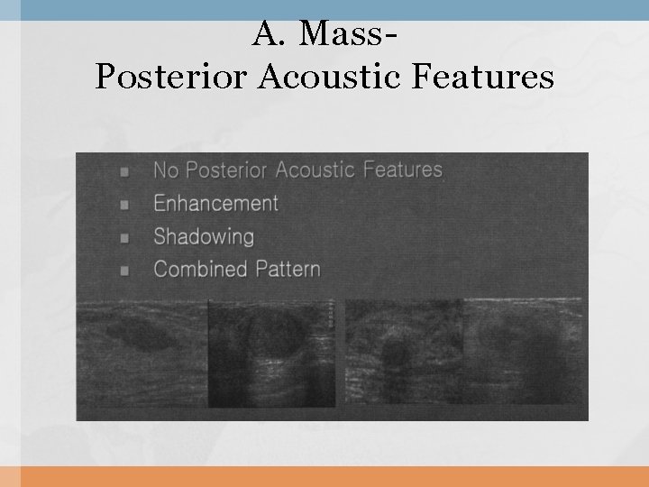 A. Mass. Posterior Acoustic Features 