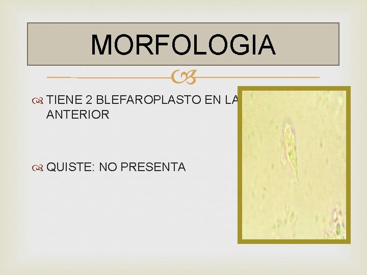 MORFOLOGIA TIENE 2 BLEFAROPLASTO EN LA PARTE ANTERIOR QUISTE: NO PRESENTA 