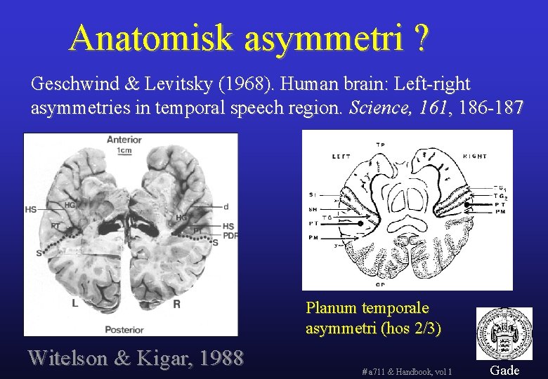 Anatomisk asymmetri ? Geschwind & Levitsky (1968). Human brain: Left-right asymmetries in temporal speech