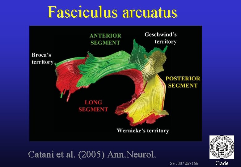 Fasciculus arcuatus Catani et al. (2005) Ann. Neurol. Se 2007 #a 716 b Gade