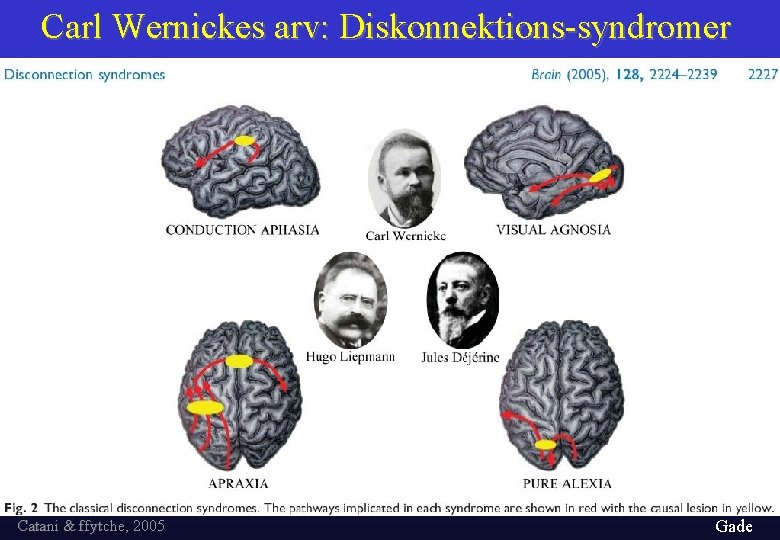 Carl Wernickes arv: Diskonnektions-syndromer Catani & ffytche, 2005 Gade 