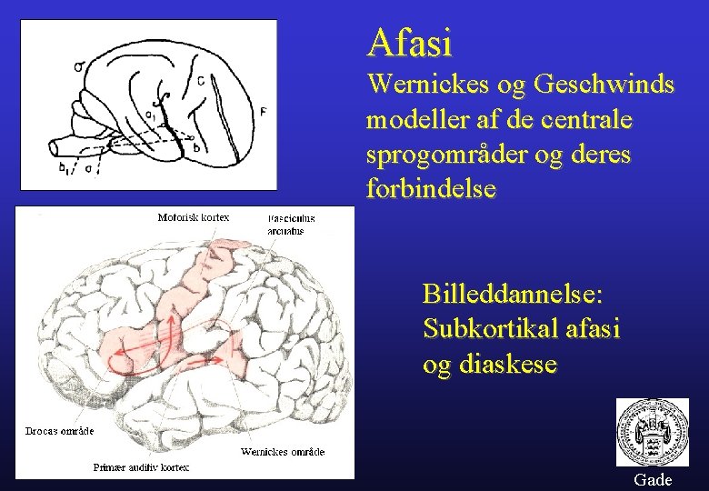 Afasi Wernickes og Geschwinds modeller af de centrale sprogområder og deres forbindelse Billeddannelse: Subkortikal