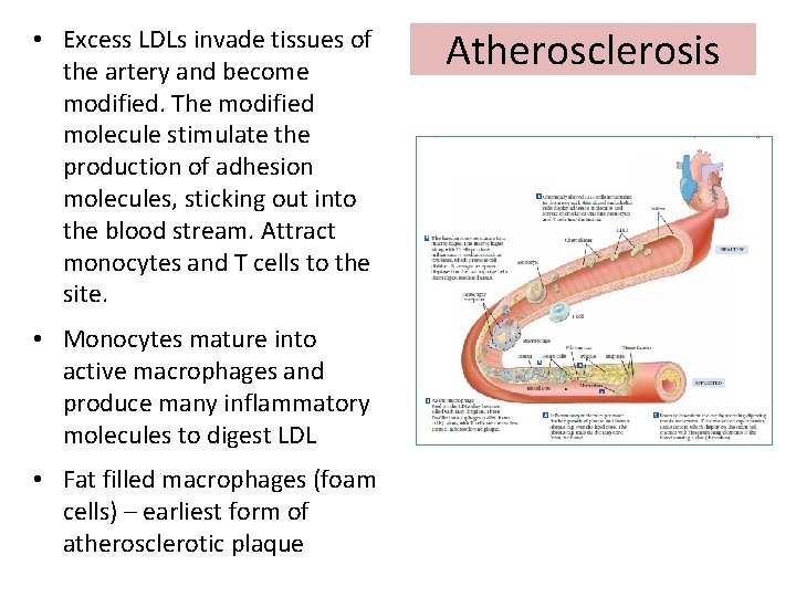  • Excess LDLs invade tissues of the artery and become modified. The modified