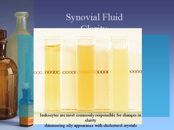 Synovial Fluid Clarity leukocytes are most commonly responsible for changes in clarity shimmering oily