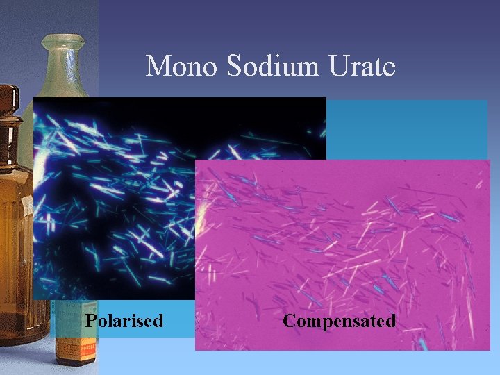 Mono Sodium Urate Polarised Compensated 