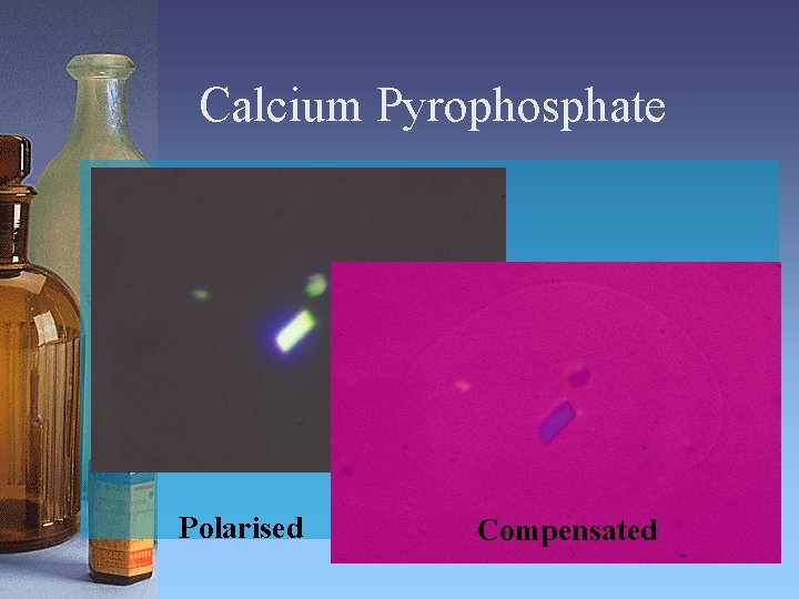 Calcium Pyrophosphate Polarised Compensated 