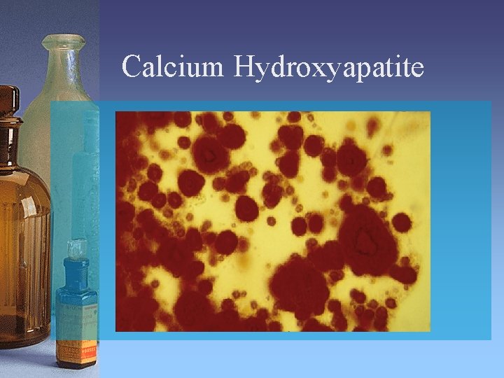 Calcium Hydroxyapatite 