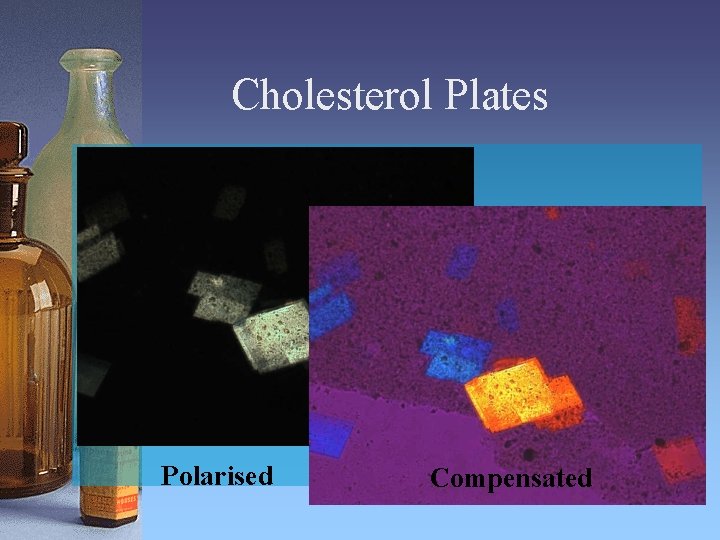 Cholesterol Plates Polarised Compensated 