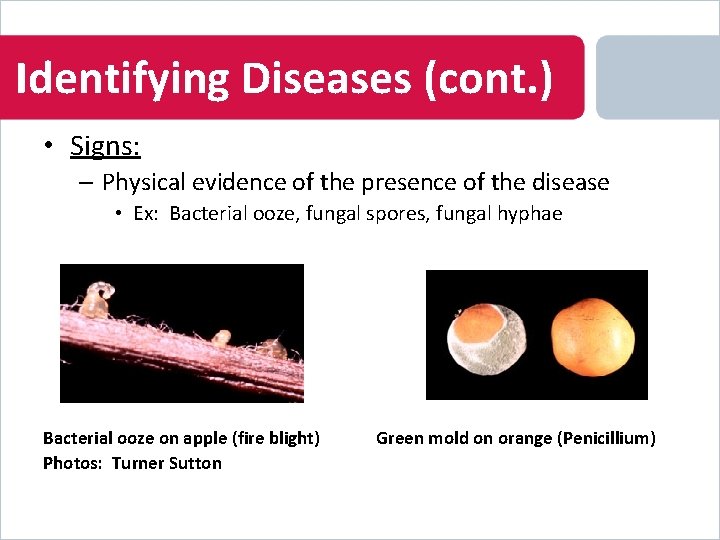 Identifying Diseases (cont. ) • Signs: – Physical evidence of the presence of the