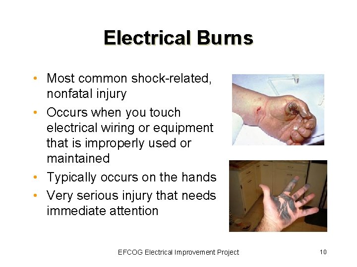 Electrical Burns • Most common shock-related, nonfatal injury • Occurs when you touch electrical