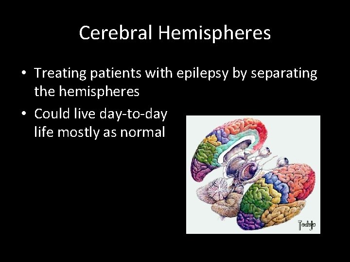 Cerebral Hemispheres • Treating patients with epilepsy by separating the hemispheres • Could live