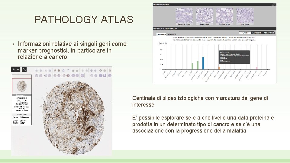 PATHOLOGY ATLAS • Informazioni relative ai singoli geni come marker prognostici, in particolare in