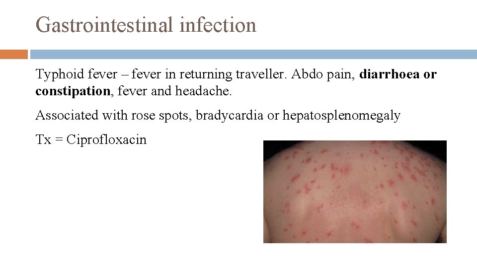 Gastrointestinal infection Typhoid fever – fever in returning traveller. Abdo pain, diarrhoea or constipation,