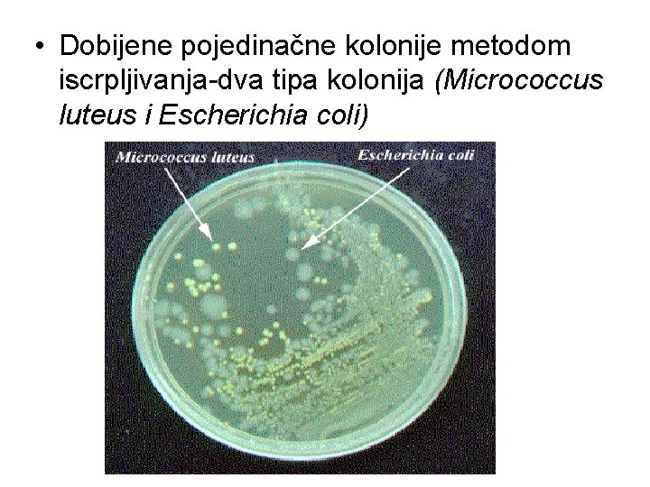  • Dobijene pojedinačne kolonije metodom iscrpljivanja-dva tipa kolonija (Micrococcus luteus i Escherichia coli)