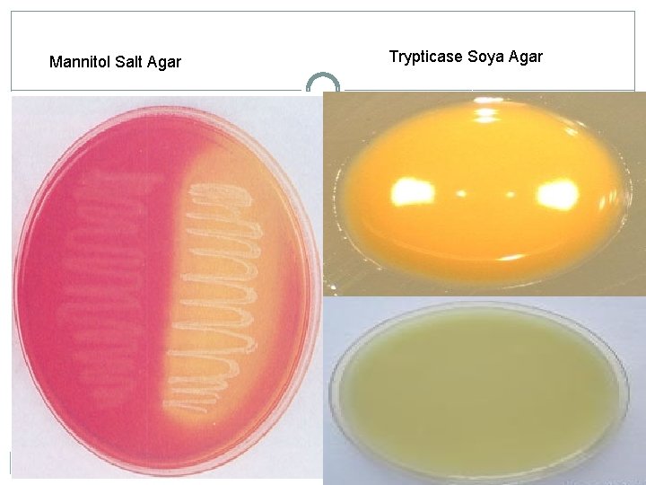 Mannitol Salt Agar Trypticase Soya Agar 