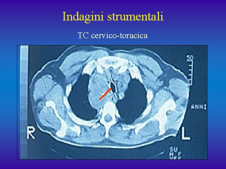 Indagini strumentali TC cervico-toracica 