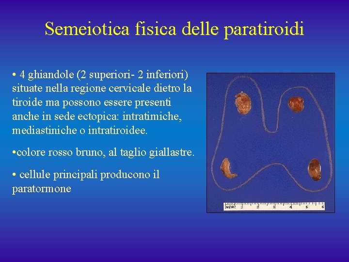 Semeiotica fisica delle paratiroidi • 4 ghiandole (2 superiori- 2 inferiori) situate nella regione