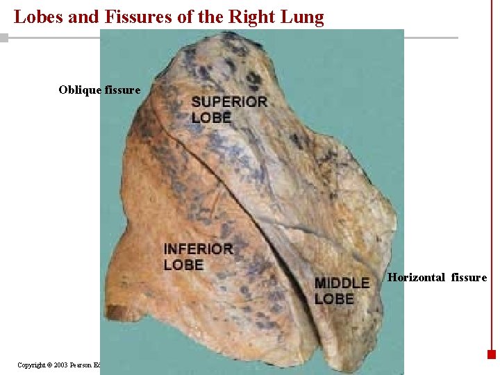 Lobes and Fissures of the Right Lung Oblique fissure Horizontal fissure Copyright © 2003