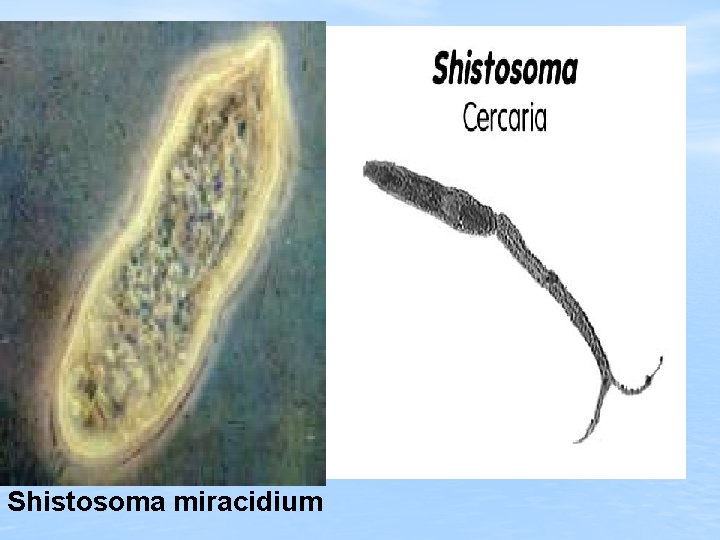 Shistosoma miracidium 