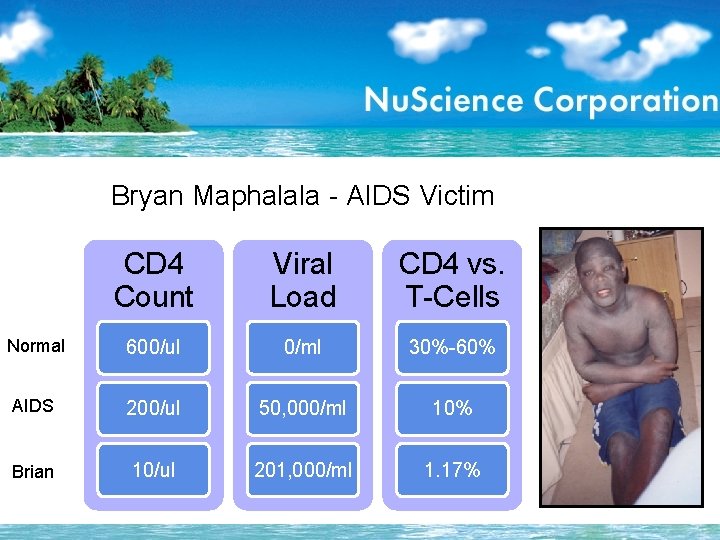 Bryan Maphalala - AIDS Victim CD 4 Count Viral Load CD 4 vs. T-Cells