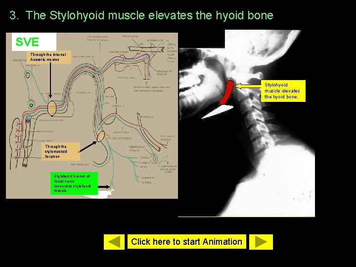 3. The Stylohyoid muscle elevates the hyoid bone SVE Through the internal Acoustic meatus