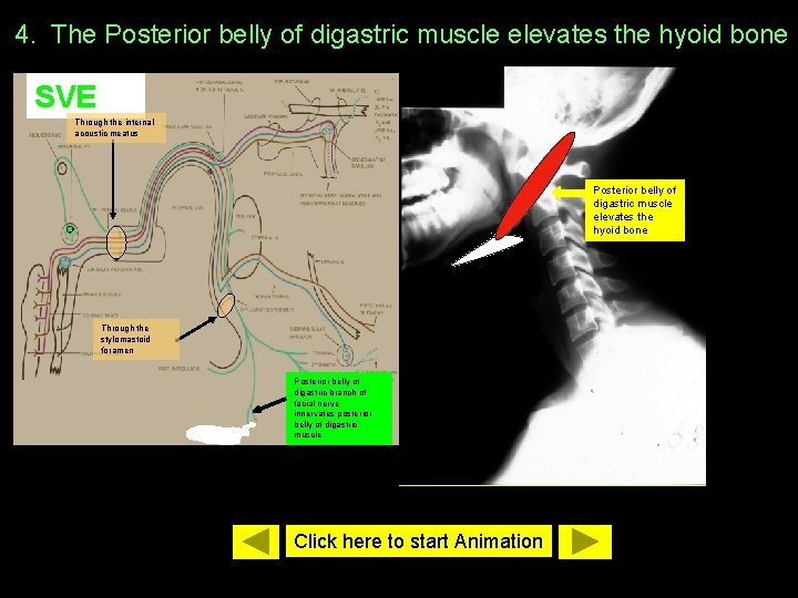 4. The Posterior belly of digastric muscle elevates the hyoid bone SVE Through the