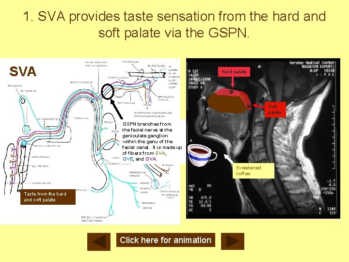 1. SVA provides taste sensation from the hard and soft palate via the GSPN.