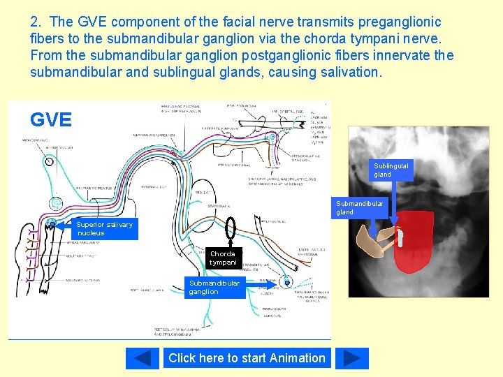 2. The GVE component of the facial nerve transmits preganglionic fibers to the submandibular