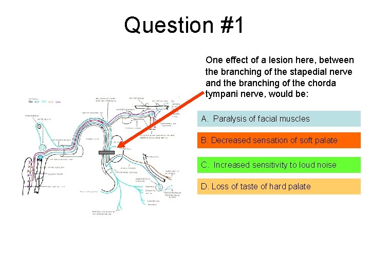 Question #1 One effect of a lesion here, between the branching of the stapedial