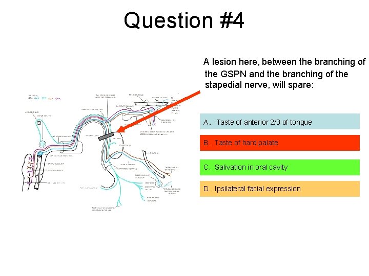 Question #4 A lesion here, between the branching of the GSPN and the branching