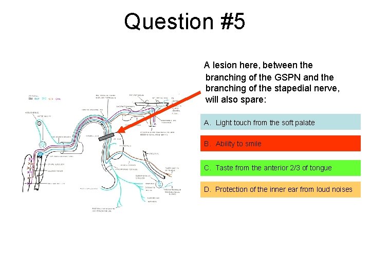 Question #5 A lesion here, between the branching of the GSPN and the branching