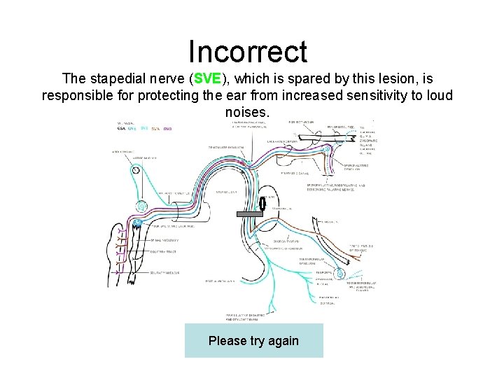 Incorrect The stapedial nerve (SVE), which is spared by this lesion, is responsible for