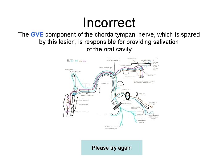 Incorrect The GVE component of the chorda tympani nerve, which is spared by this